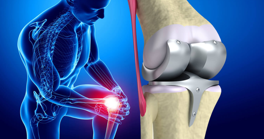 Diz Protezi Ameliyatı Sonrası