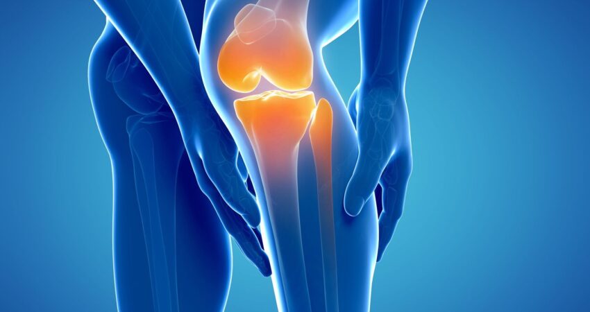 Diz Eklemi Kireçlenmesi
