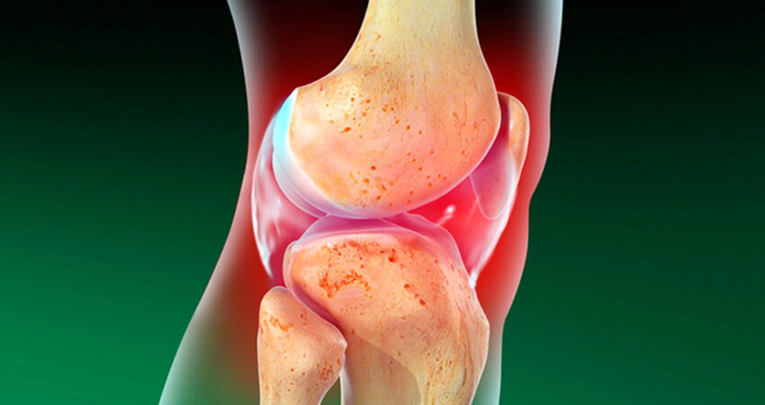 Gençlerde Diz Kireçlenmesi