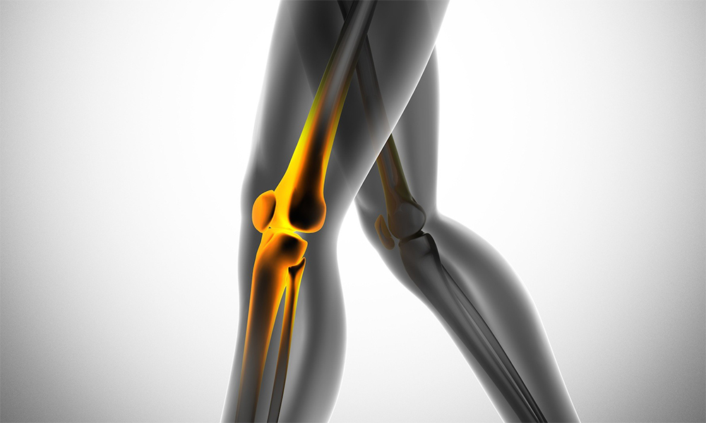 Ön Çapraz Bağ Ameliyatı