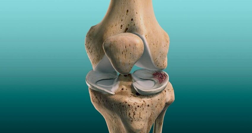 Menisküs Yırtılması